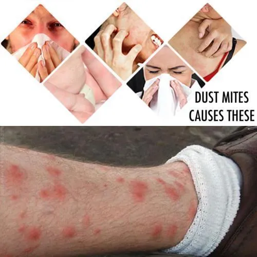 Dust Mite Killing Pad